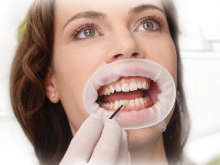 Optragate regular hvid 590850 