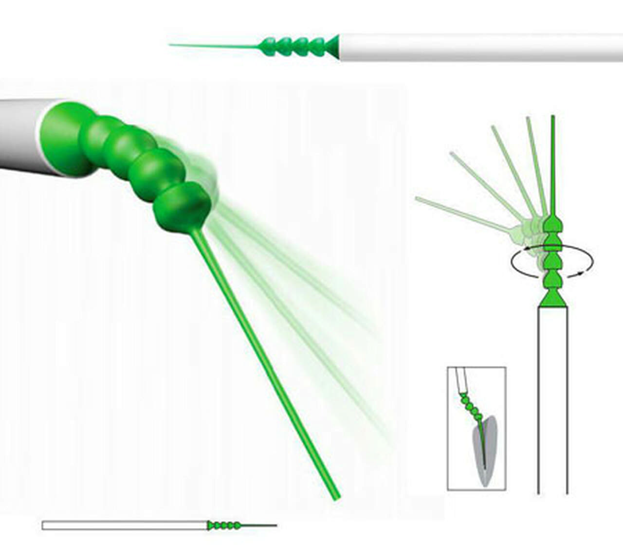 Surgitip endo sug  60018280