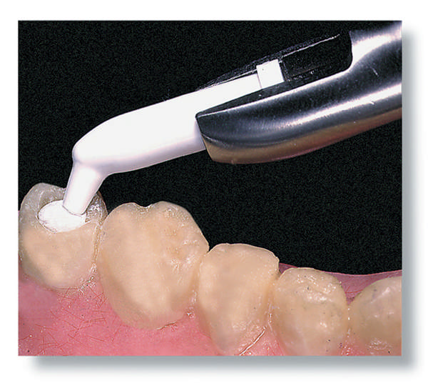 Tempit kapsler 310060